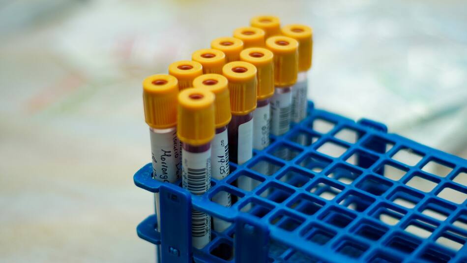 Los individuos con sangre tipo B tienen una mayor capacidad de adaptación