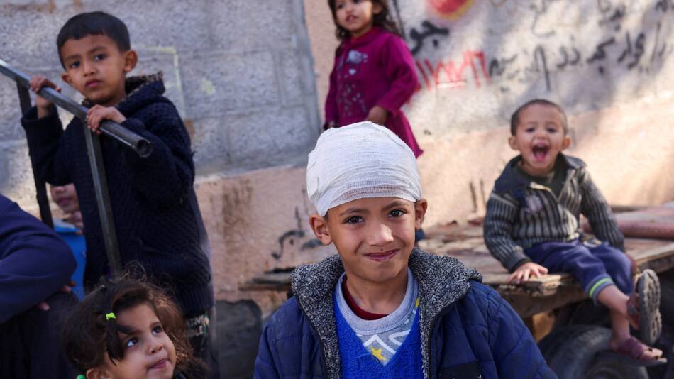 Mysara Abu Telakh, un niño palestino desplazado que resultó herido en un ataque israelí, observa en Rafah. Foto: Reuters