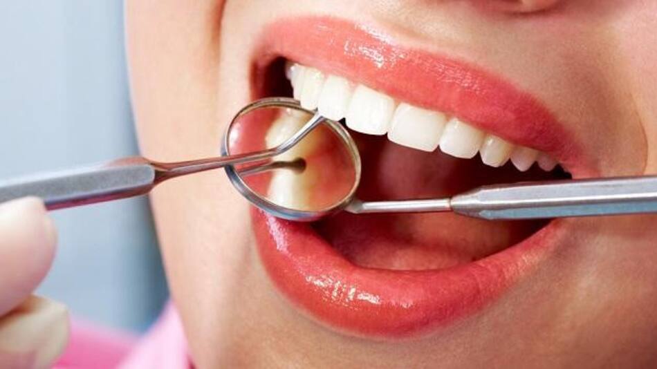 Limpieza bucal - salud