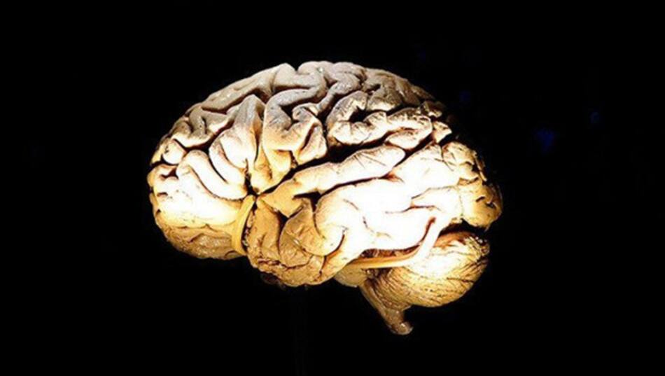 Cerebro