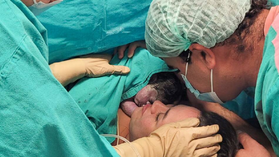 Beba que fue operado en el útero de su madre en el Hospital Garrahan. Foto: Gentileza Hospital Garrahan.