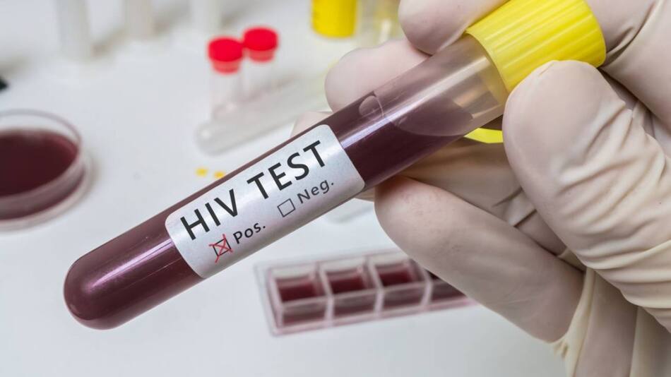 El sida, una enfermedad cuya cura aún no fue desarrollada. Foto: redes sociales.