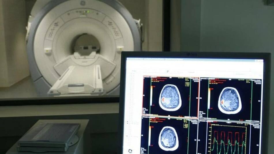 Alzheimer, salud. Foto: Reuters.